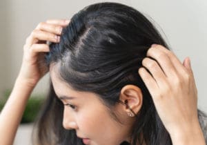 The Menopause Clinic - Hormonal hair loss in women